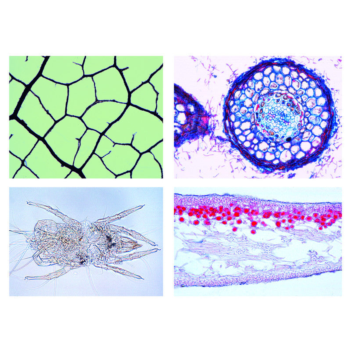 Préparations microscopiques Sol III : vie et structure du sol, 17 pièces - LIEDER