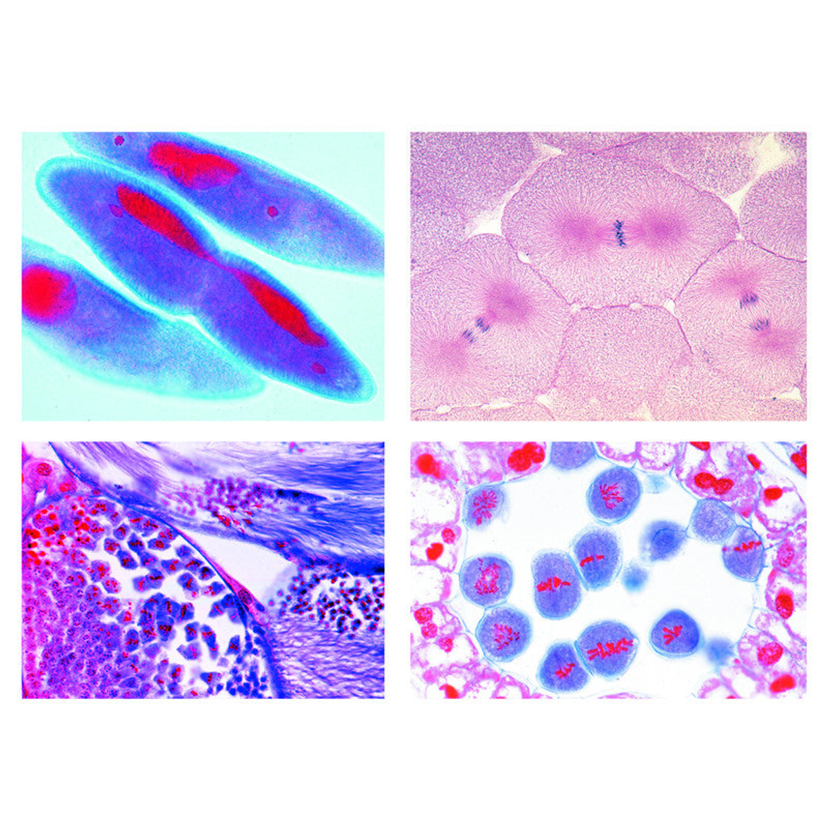 Série II Mitose et Méiose – 5 Préparations Microscopiques - LIEDER