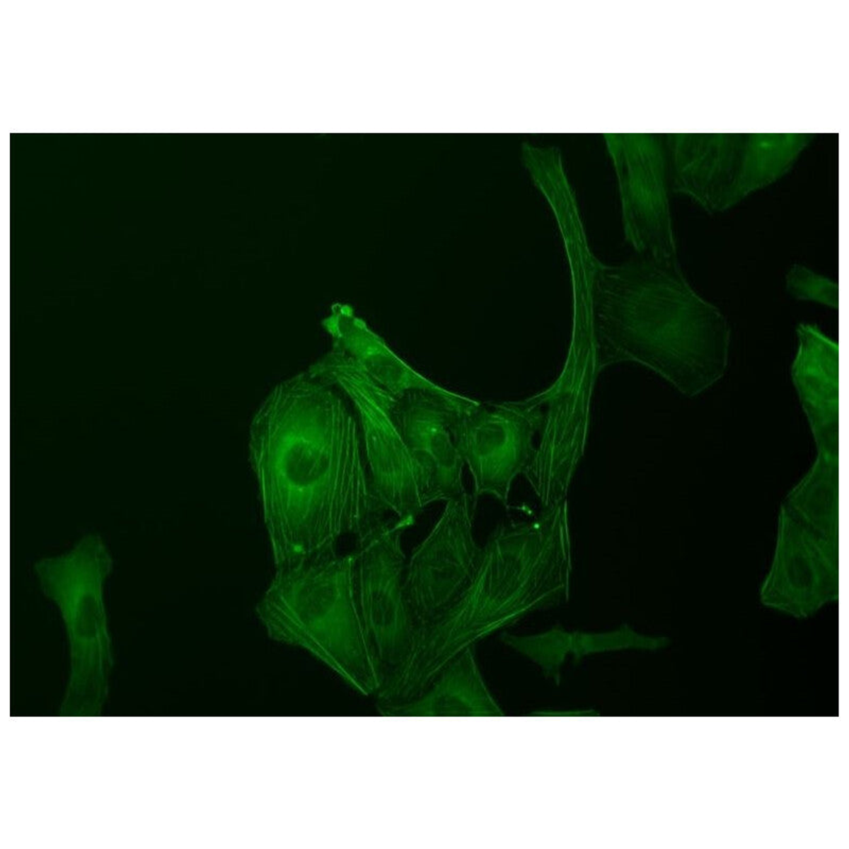 Microscope inversé trinoculaire Primovert PH1 40x-400x - ZEISS